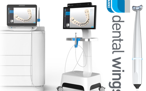 In Arrivo lo Scanner 3D di Dental Wings